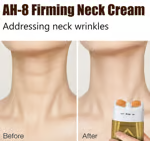 π©βπ¦° Hot Sale 49% OFFπΏ - Neck Firming Cream